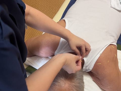 はり（鍼）による施術の様子